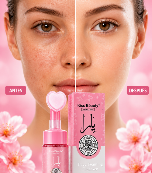 Crema  Aclarante - Kiss Beauty
